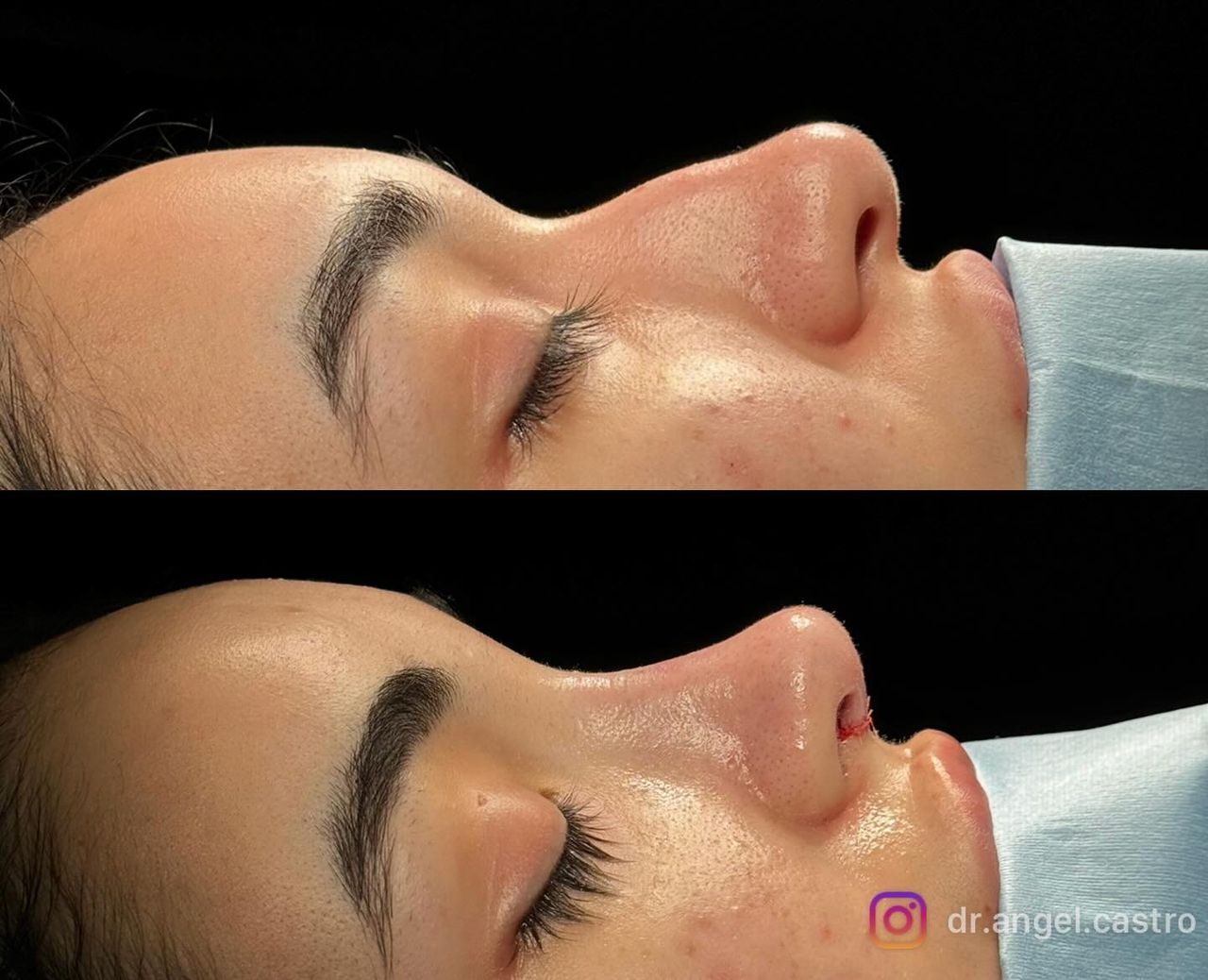 Angel Castro Urquizo-80