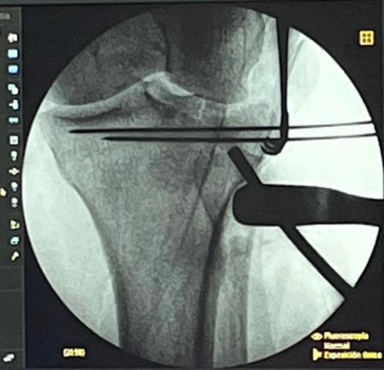 Gisela Cleto Zepeda-171