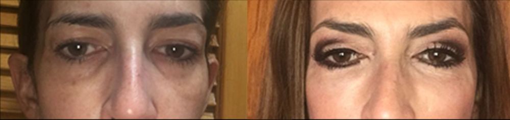 Edgar Ernesto Torres Mejía-24