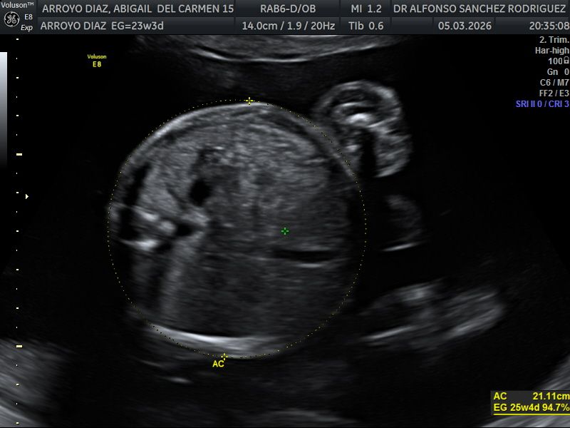 Alfonso Sanchez Rodriguez-67