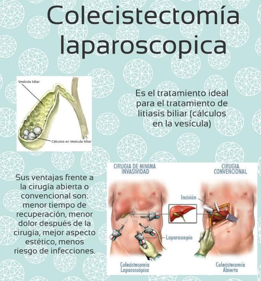 Laura Irazema Hernández González-3