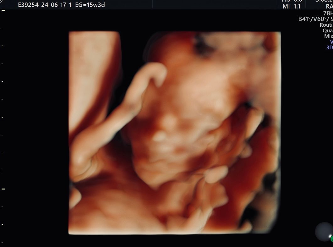 Erik Fernando González Martínez-8