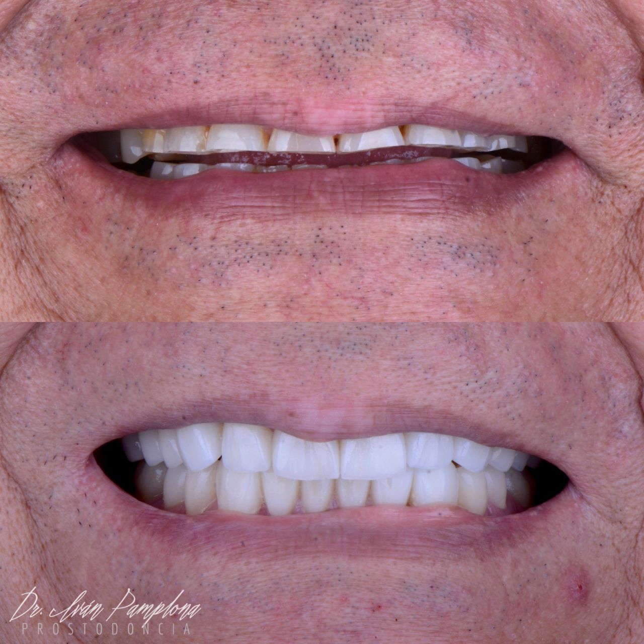 Iván Gerardo Pamplona Alfaro-0