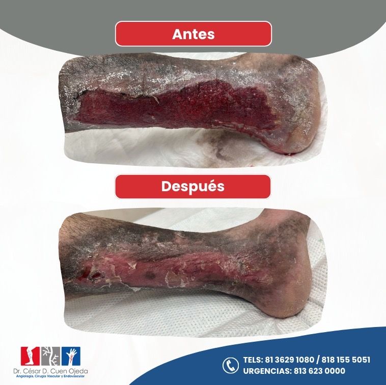 César Daniel Cuen Ojeda-7