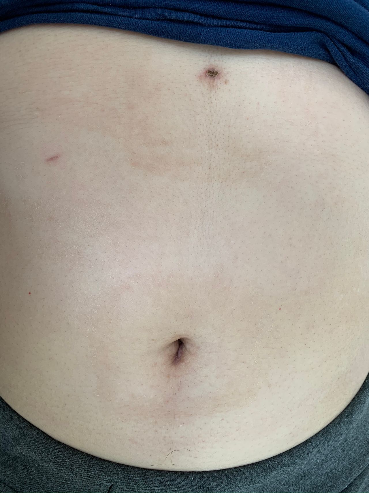 Diego Edwuin Rosales Carmona-14