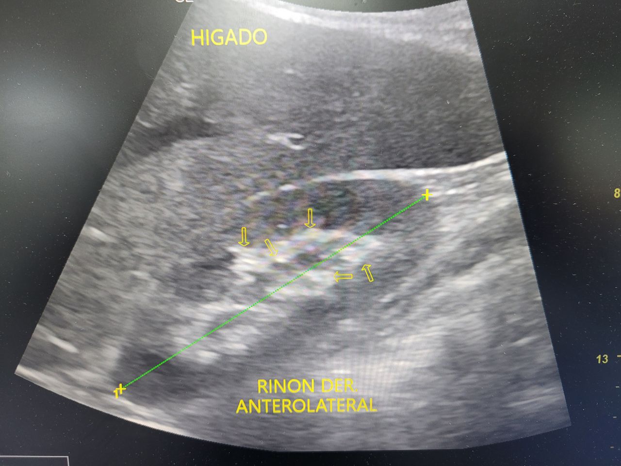 Einar Arik Nuñez Sanchez-5