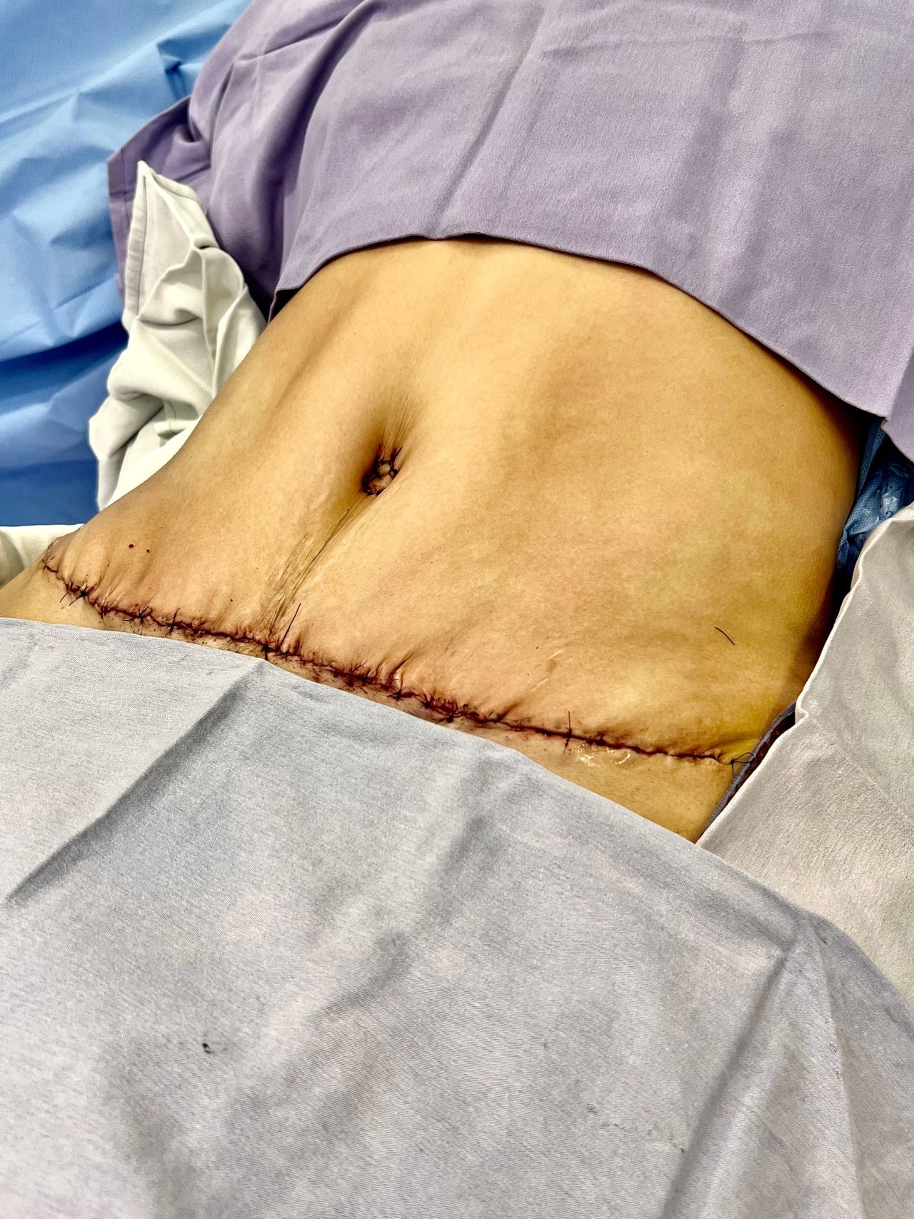 Carlos Alberto Ruiz Zepeda-26