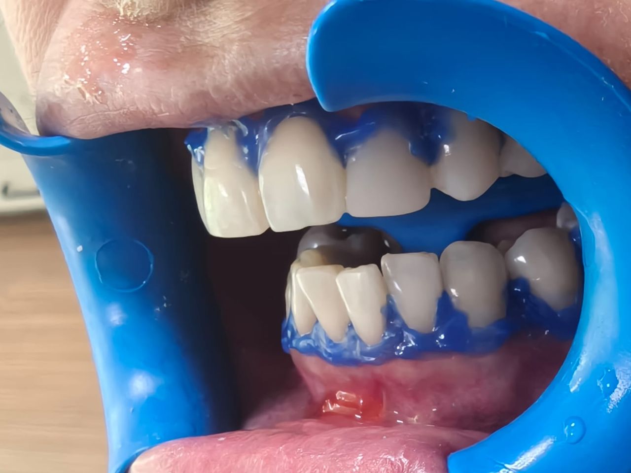 Pedro Badial Aceves-10