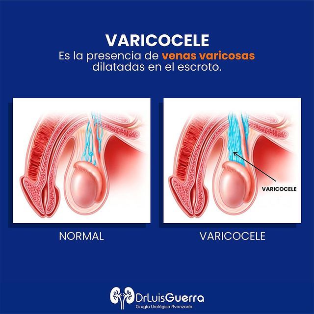 Luis Alberto Guerra Zepeda-36