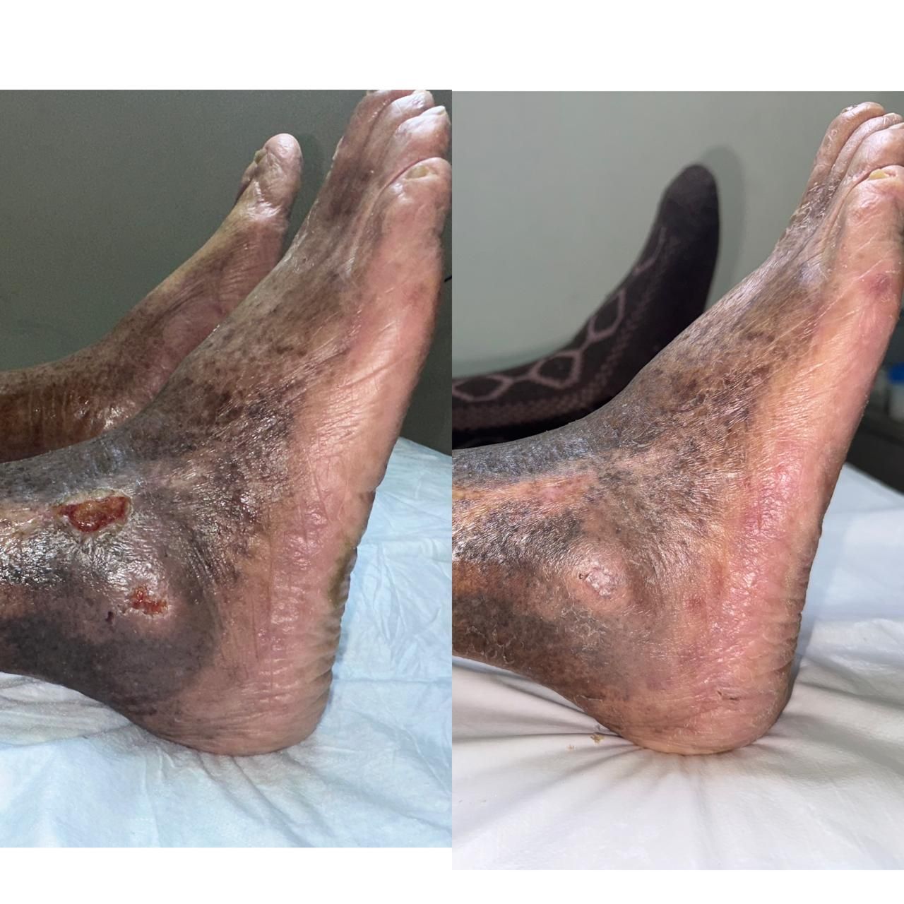 Jhonatan López González-17