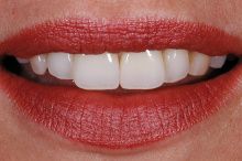 Jose David Torres Hernandez-24