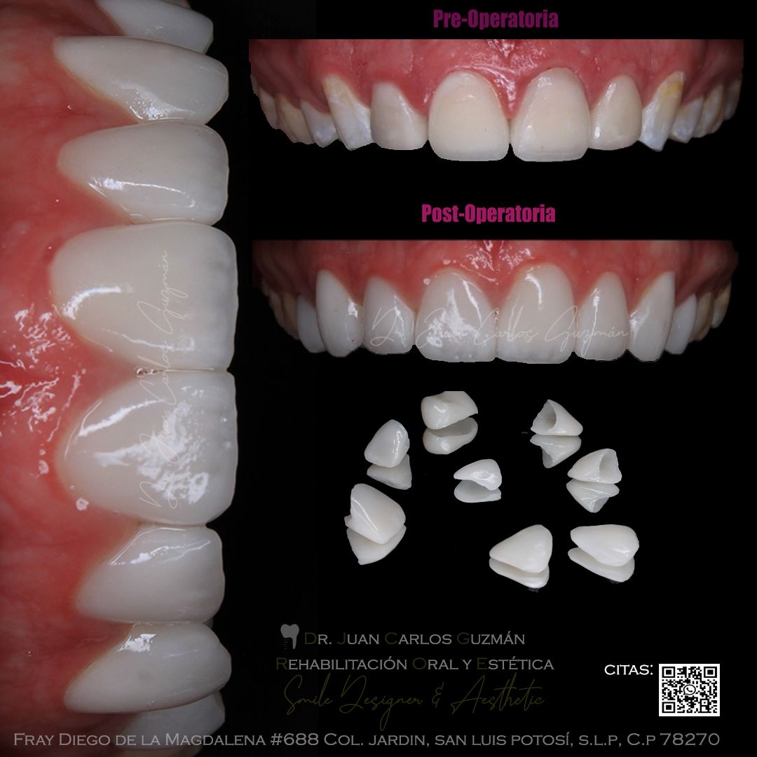 Juan Carlos Guzmán Castañeda-25