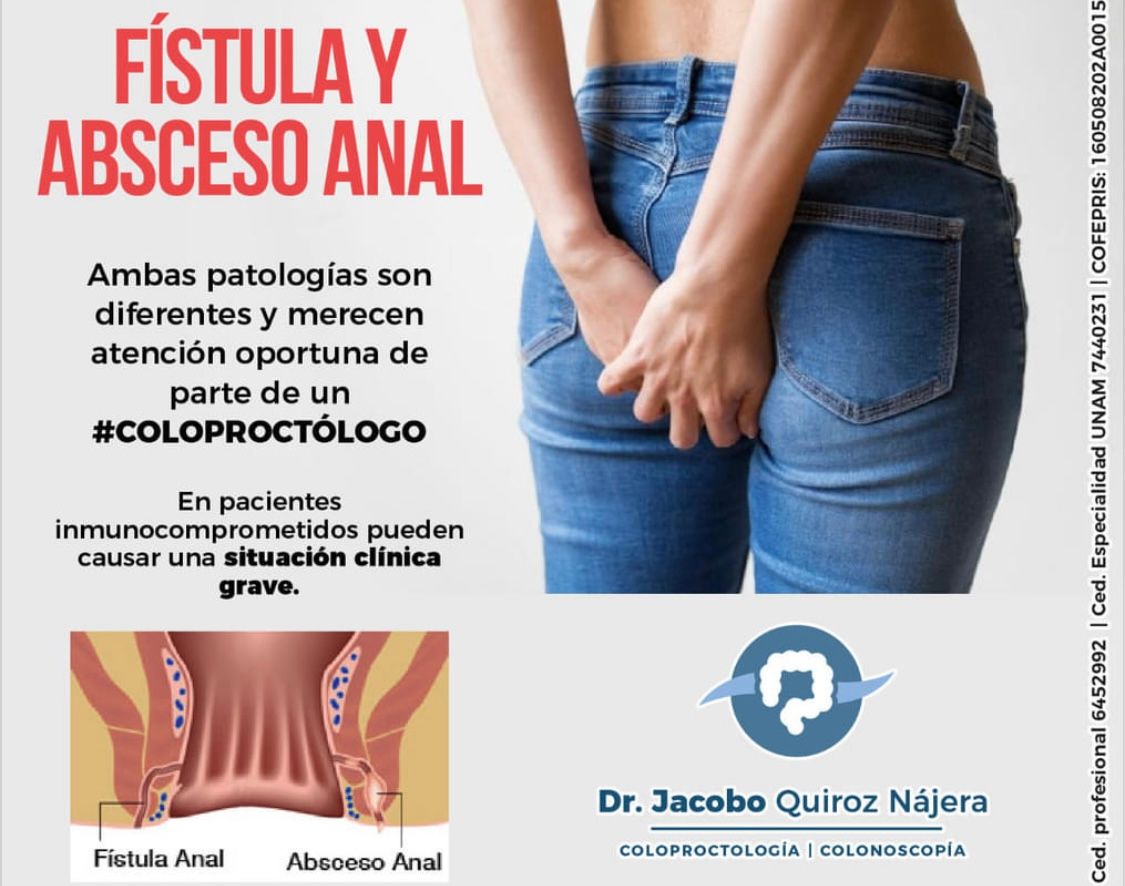 Jacobo Quiroz Nájera-66