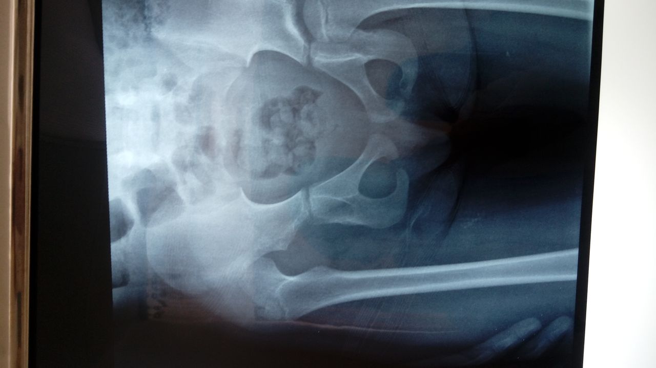 Valerio Licerio De La Cruz-6