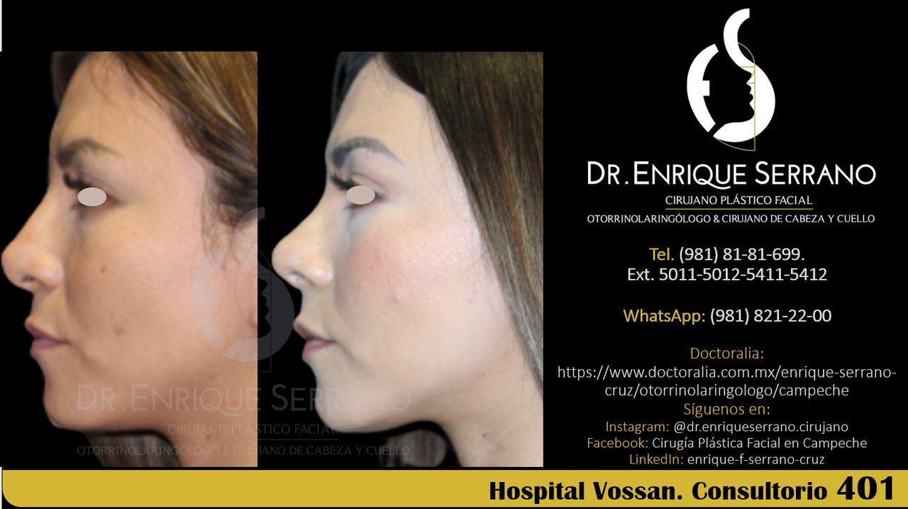 Enrique Serrano Cruz-83