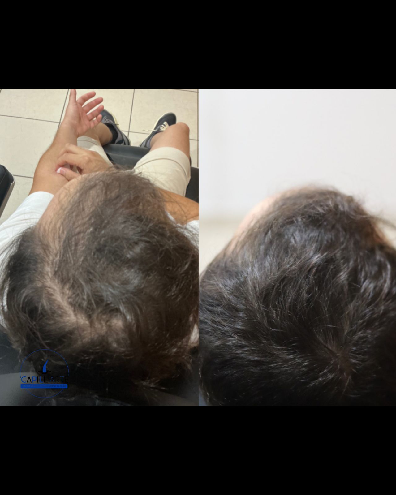 Adrian Hernandez Lopez-10