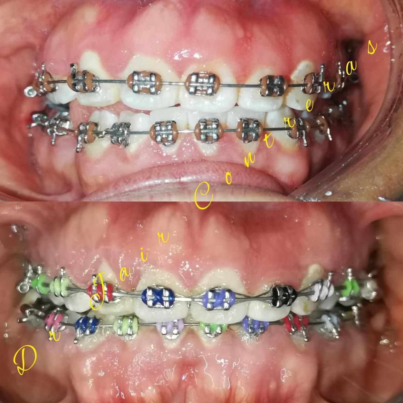 Jair Contreras García-13