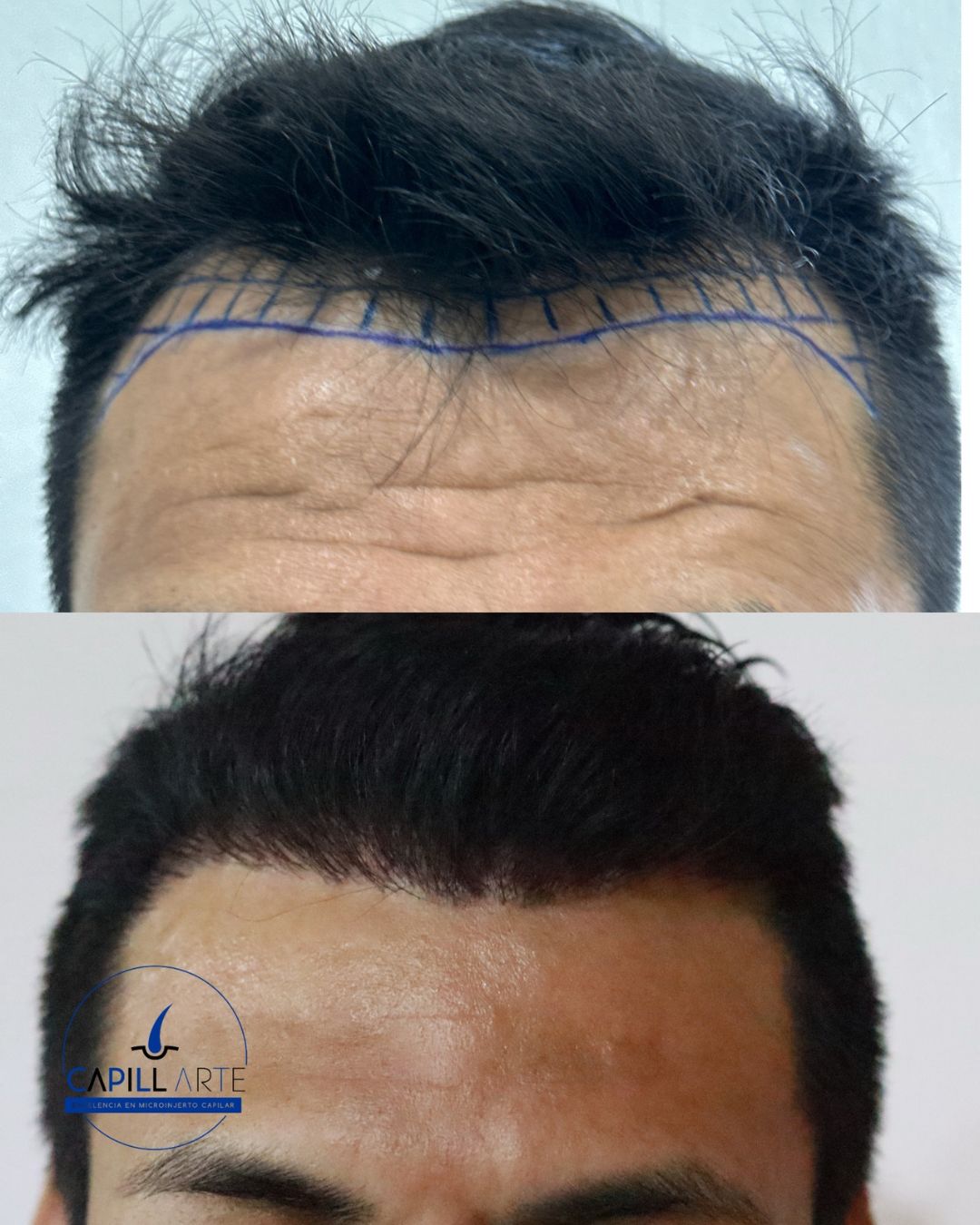 Adrian Hernandez Lopez-22