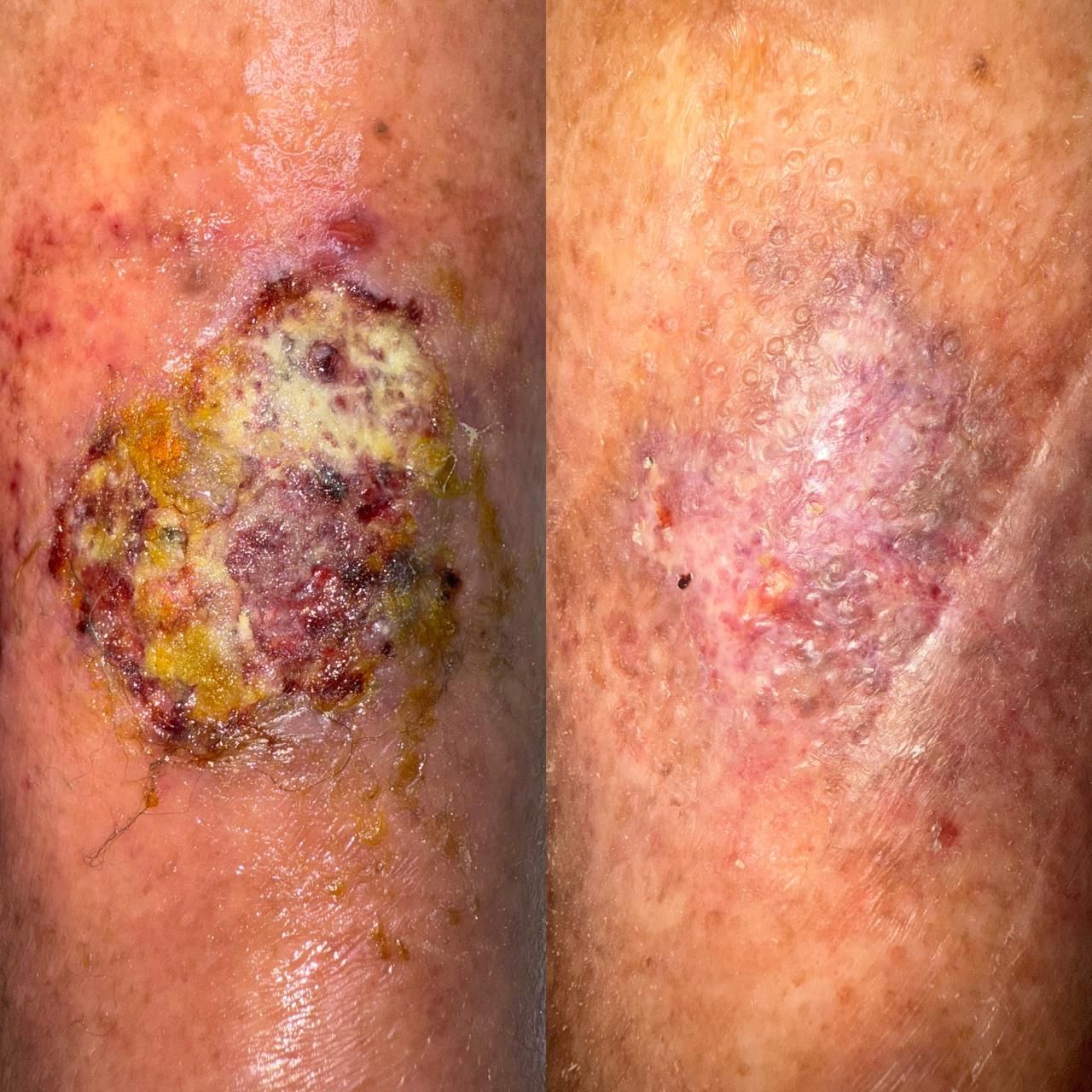 Jhonatan López González-69