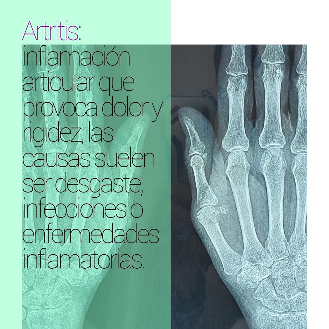 Elliu Demesiris Zúñiga Manriquez-3