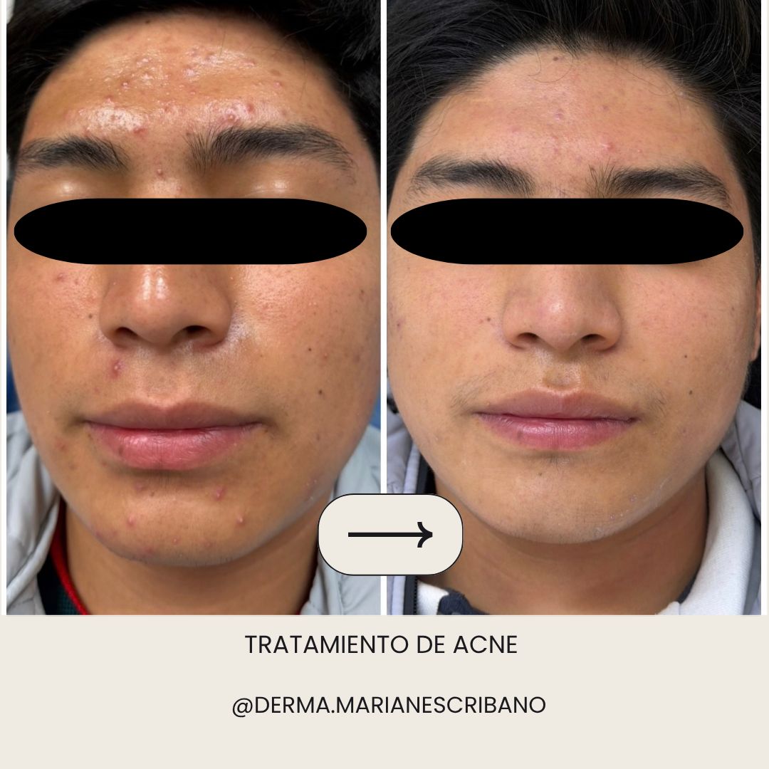 Marian Escribano Ponce-5
