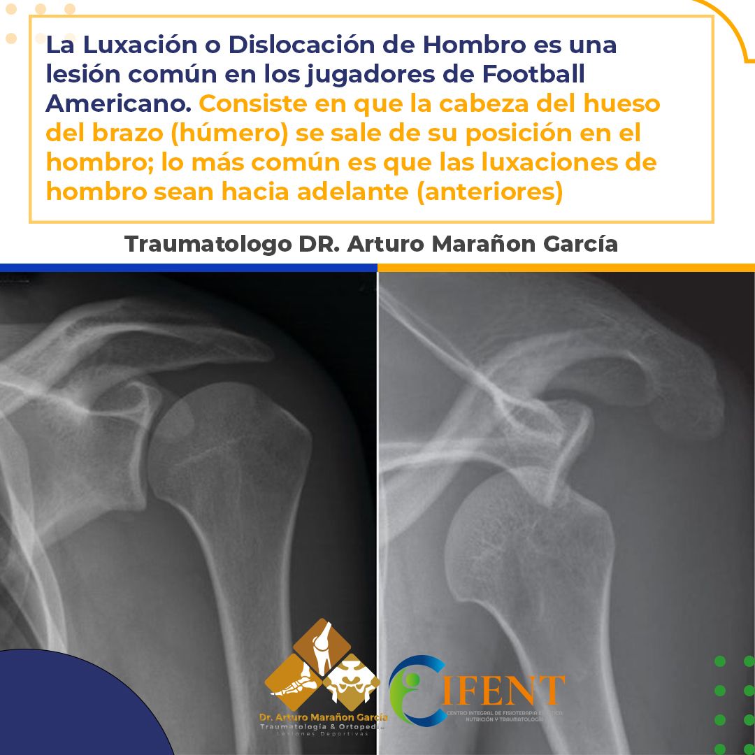 Arturo Marañon Garcia-1