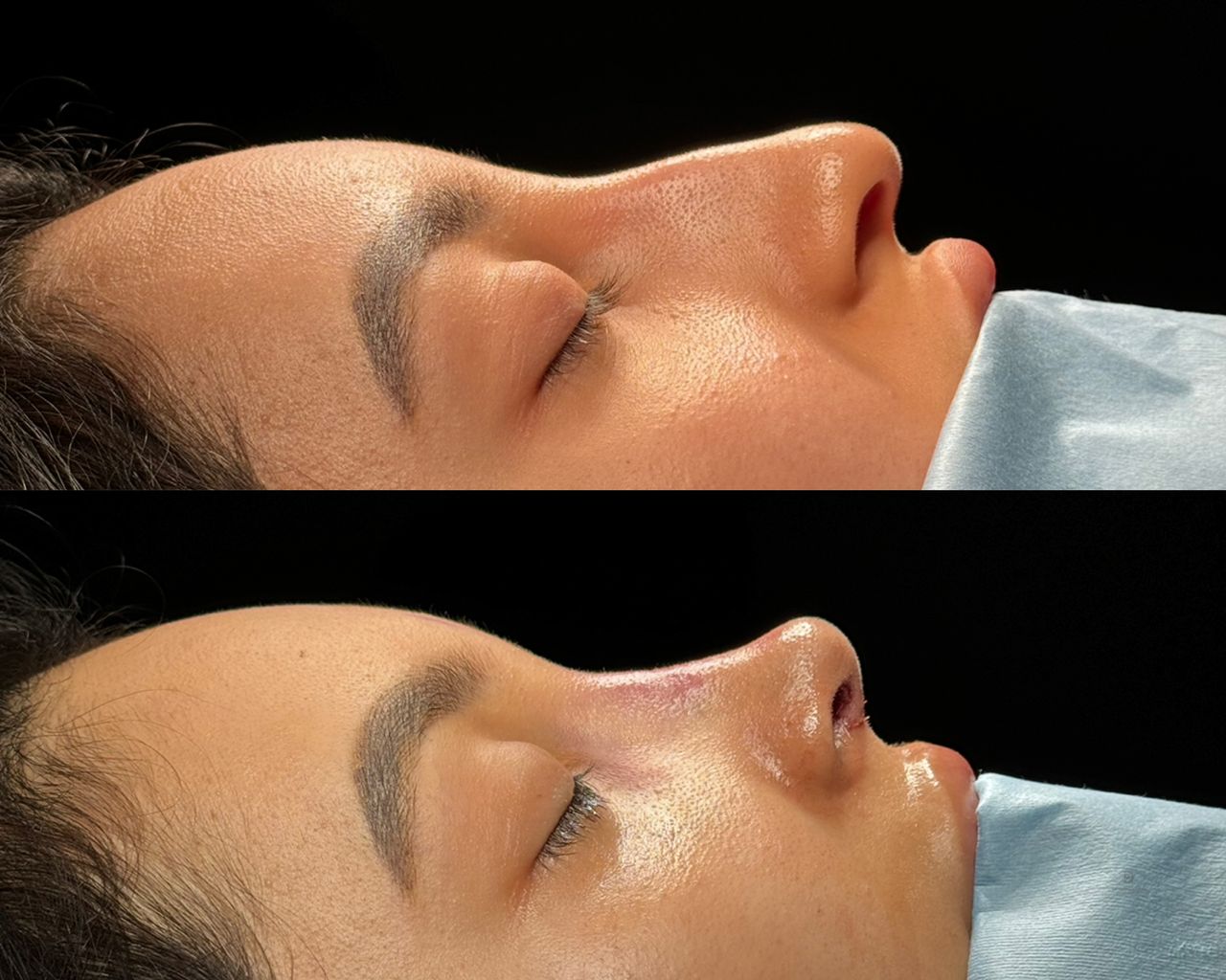 Angel Castro Urquizo-64