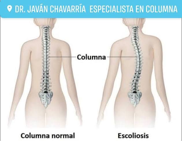 Javan Sinuhe Chavarría  Jacinto-5