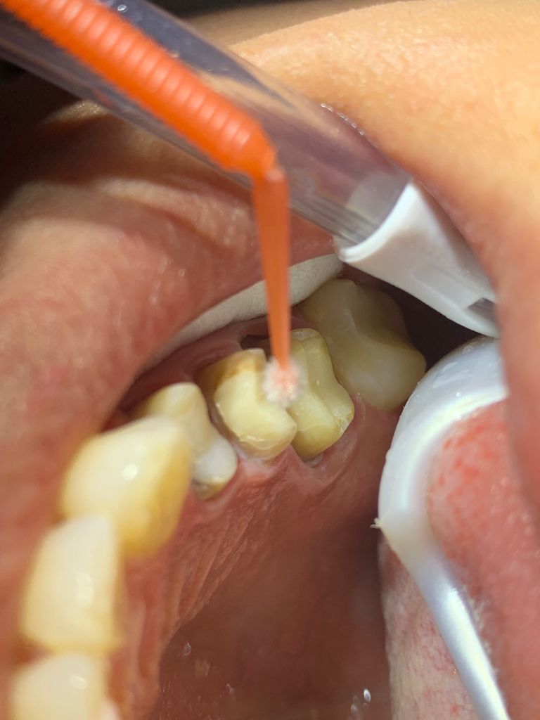 Yuriria Gochy Escalante-6