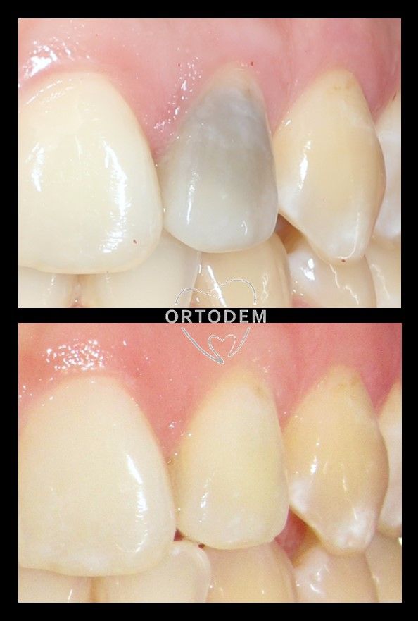 Elizabeth Morelos Morales-13