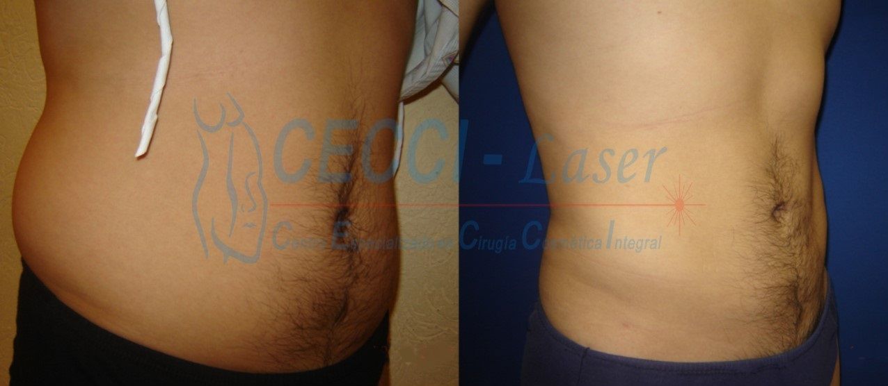 José Leopoldo Rojas Garza-4