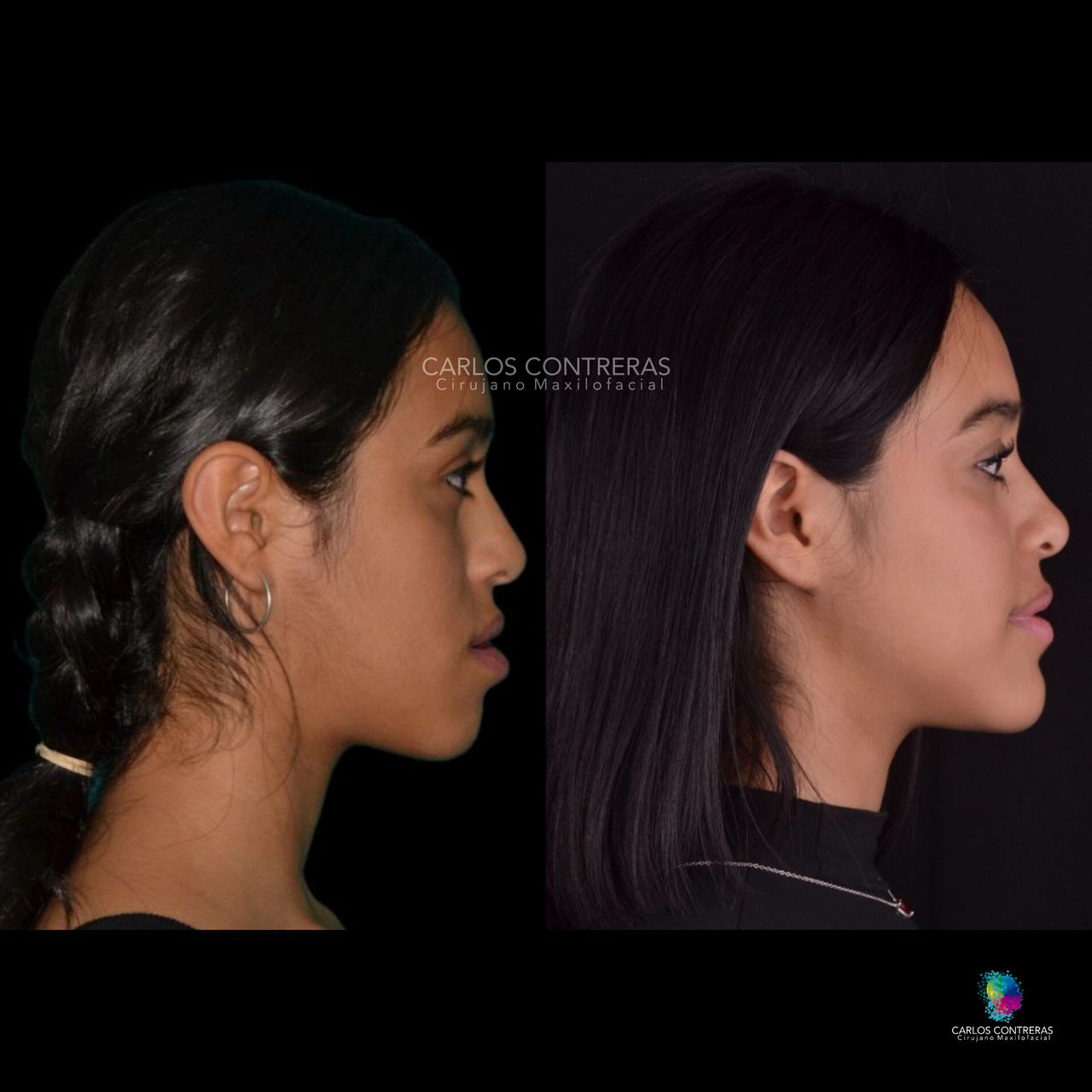 Carlos Ernesto Contreras Castellanos-1