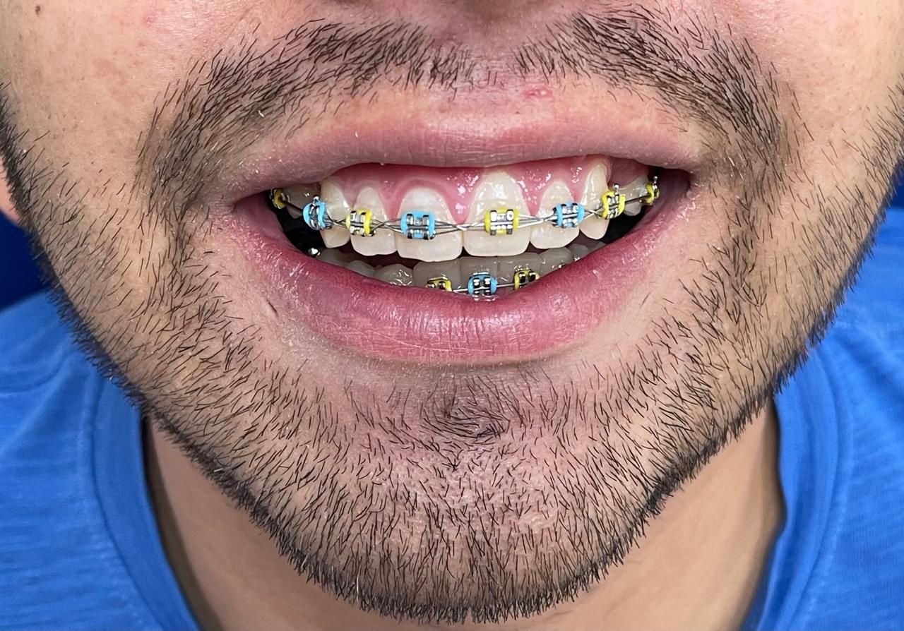 Anuar Becerril Castro-15