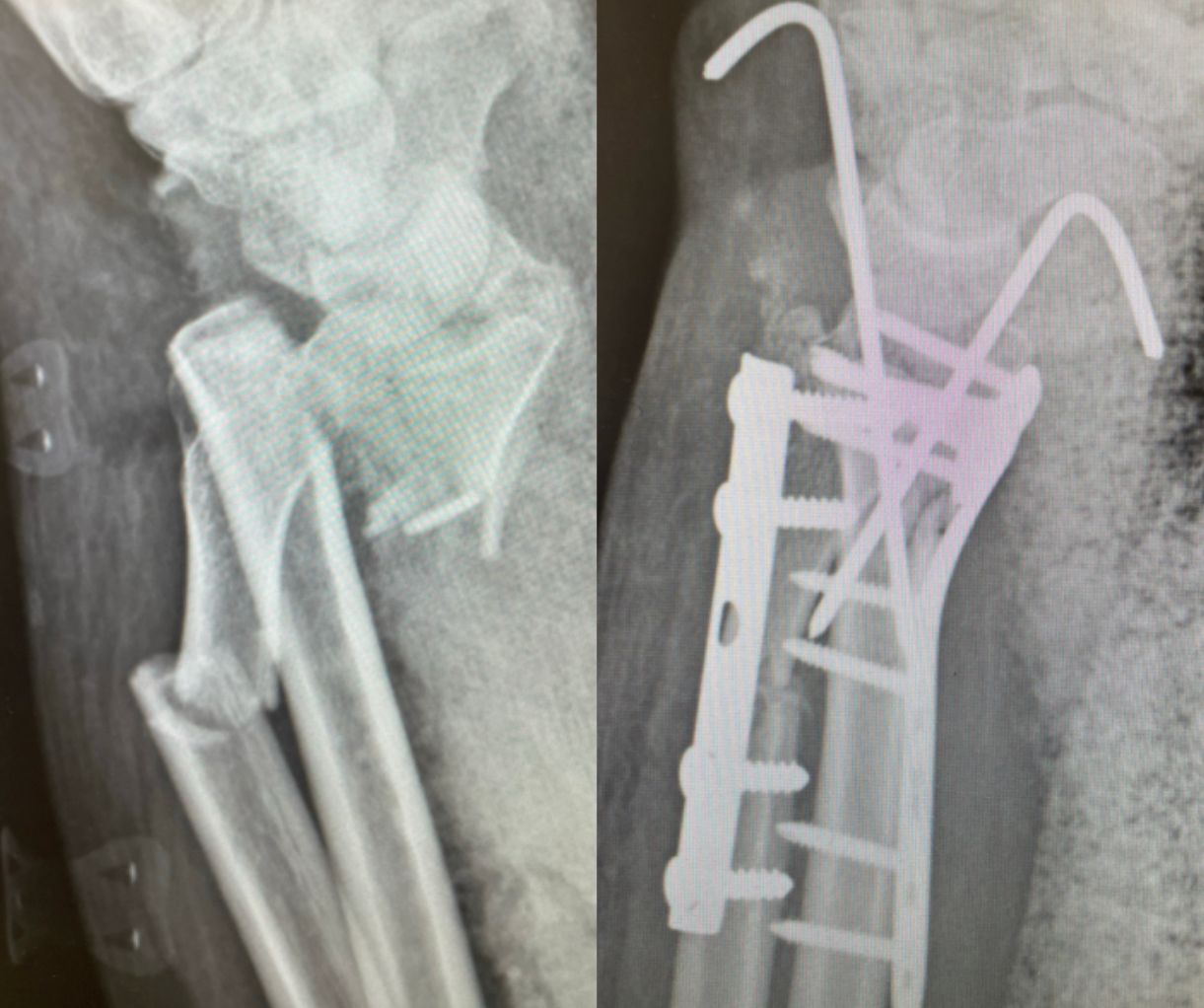 Diego Armando Contreras Rojas-5