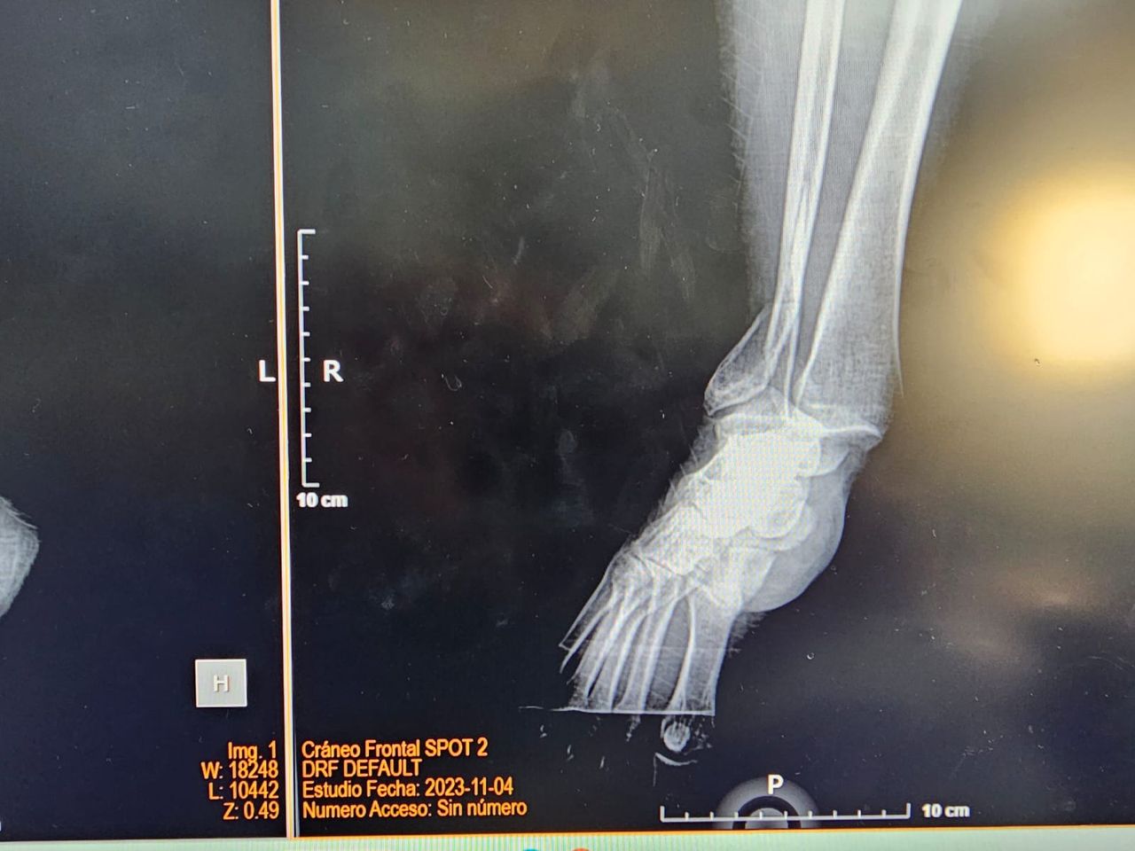 Juan Pablo Flores Pinzon-1