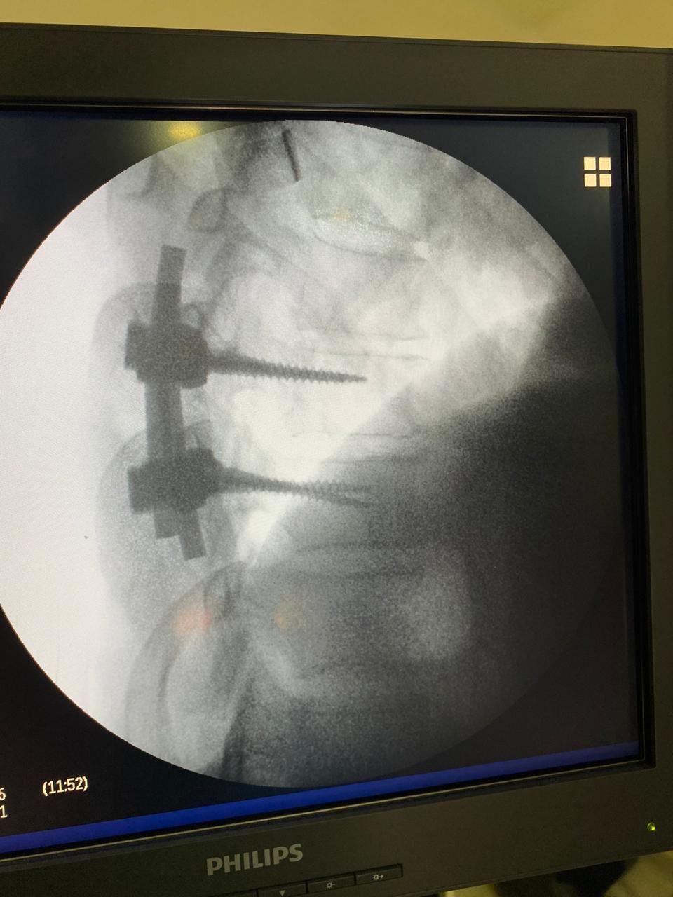 Juan José Luévano De La Cruz-40