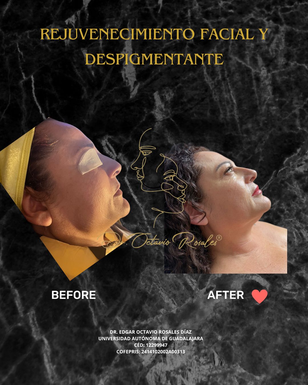 Edgar Octavio Rosales Diaz-21