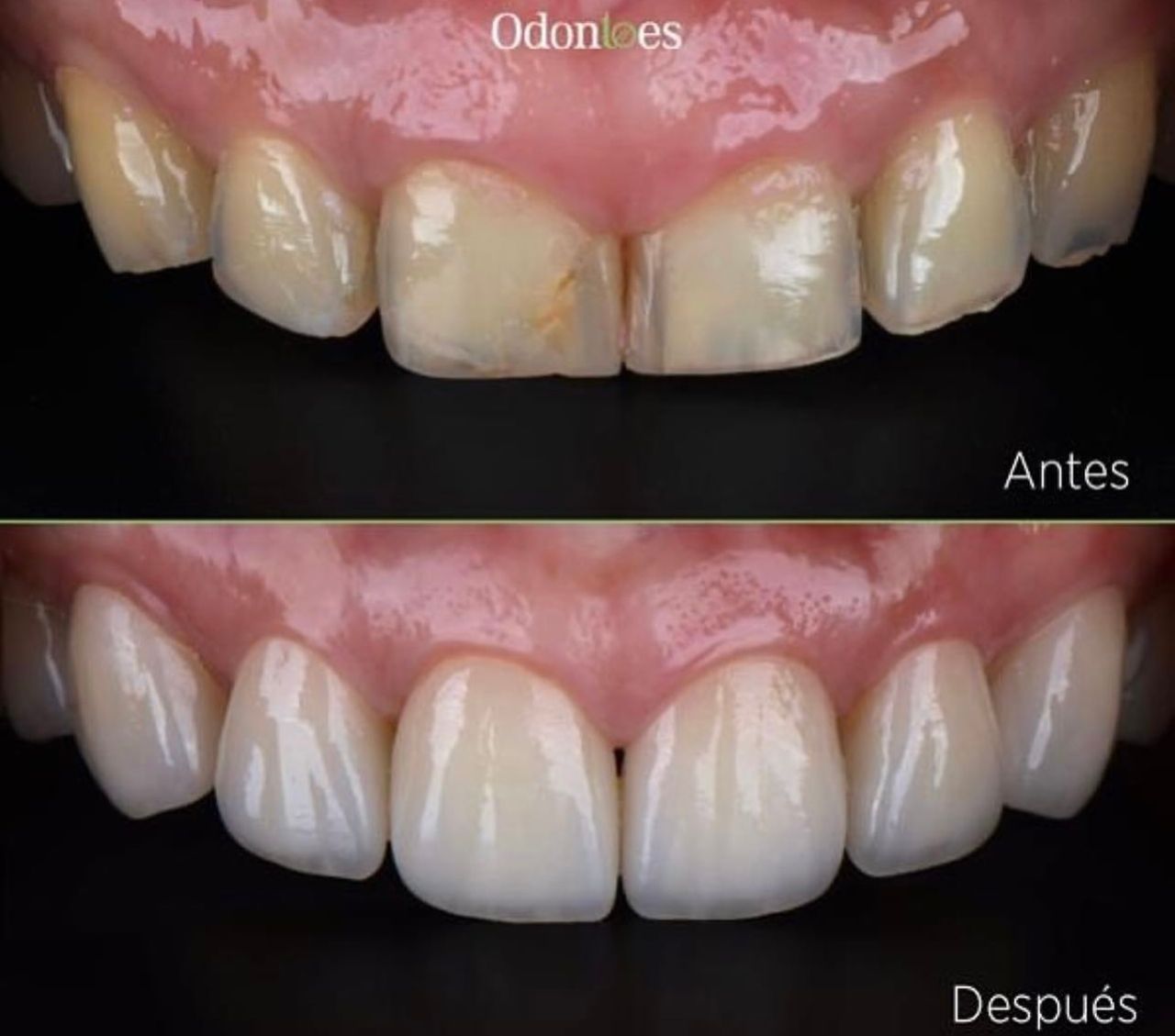 Raúl Euán Salazar-11