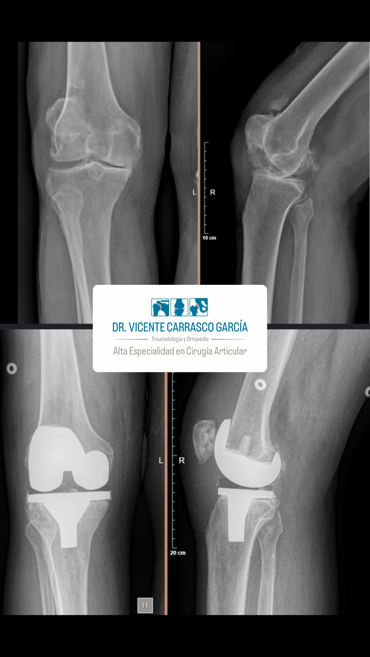 Vicente Carrasco García-21