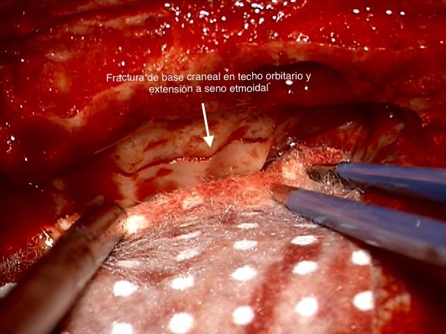 Celia Teresa De Jesús Álvarez Gamiño-35