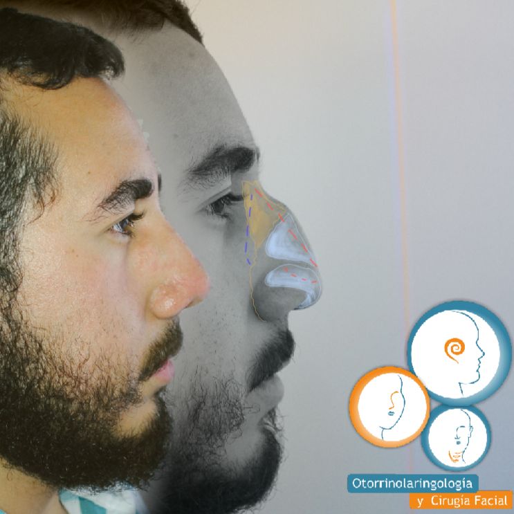 José Christian Ávila Romero-6