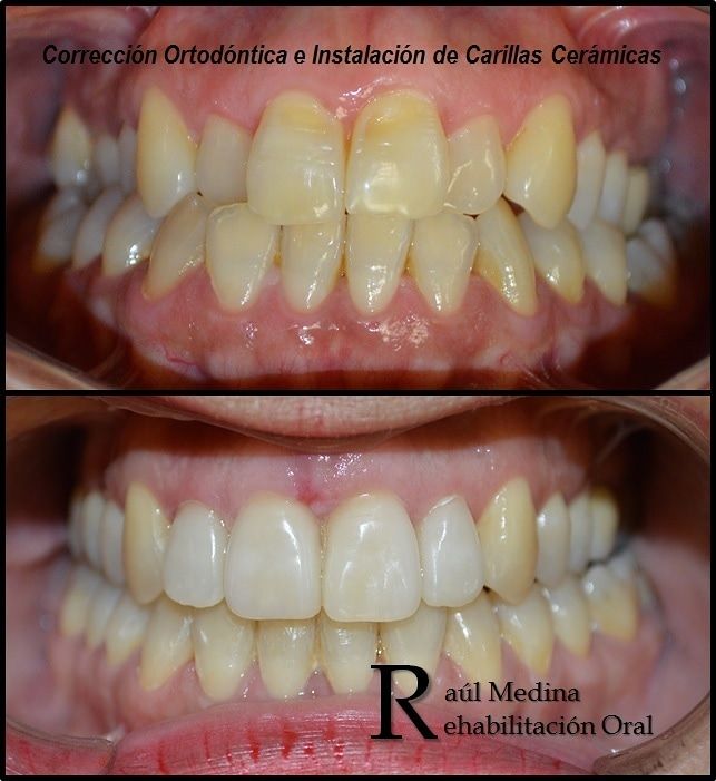 Raúl Uriel Medina Martinez-5