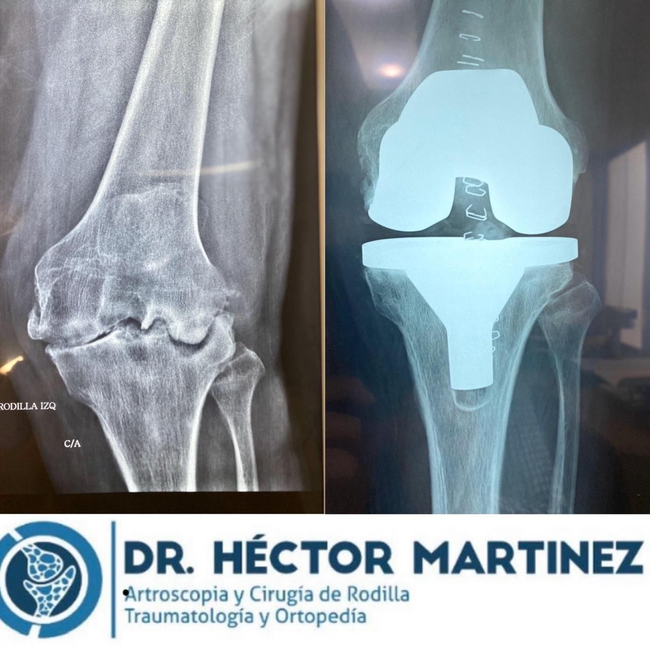 Héctor Rául Martínez Ayala-59