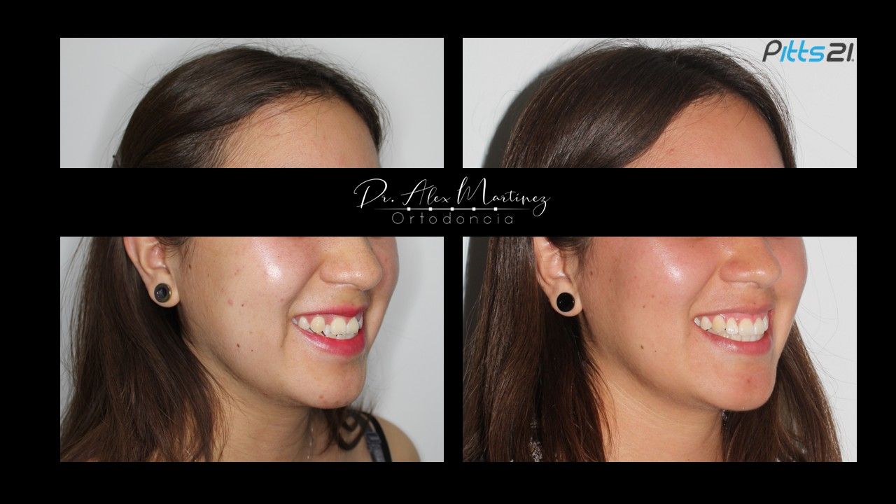 Alejandro Martínez Hernández-23