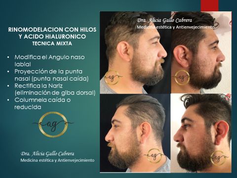 Alicia Gallo Cabrera-18