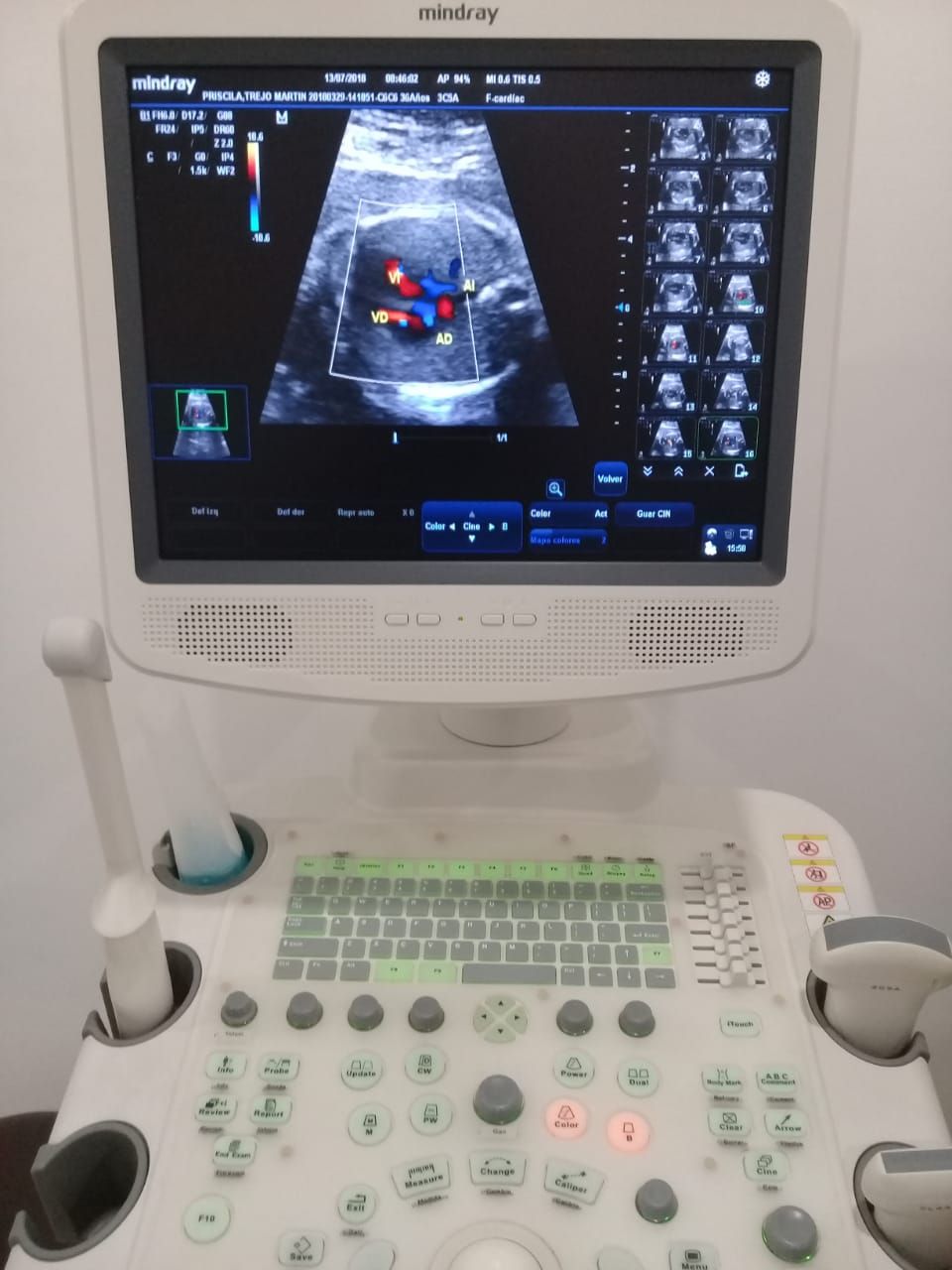 César Alejandro Rodríguez Benitez-4