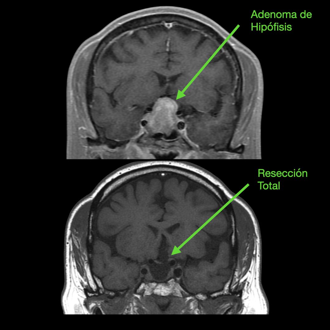 José De Jesús Martínez Manrique-4