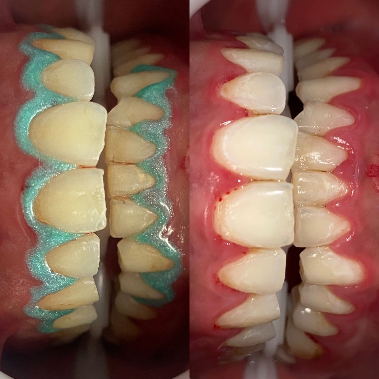 Adriana Moreno Jimenez-15