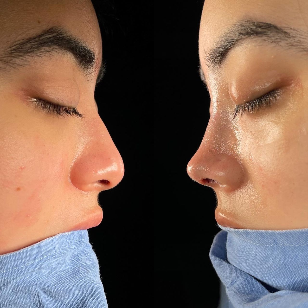 Angel Castro Urquizo-166