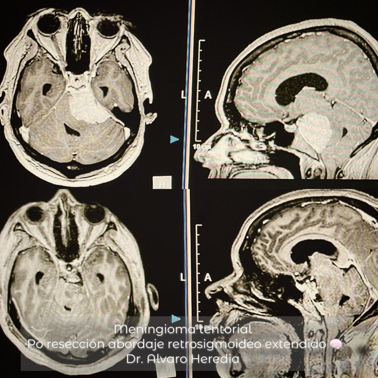 Juan Antonio Alvaro Heredia-10